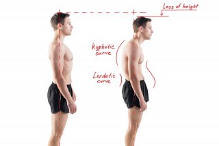 Posture correction