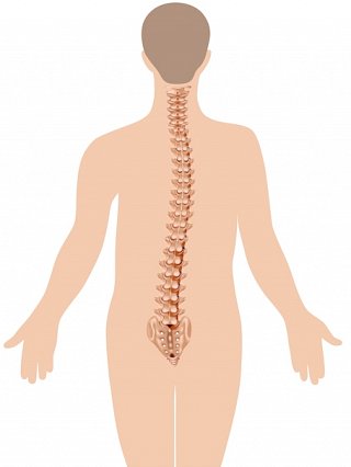 Lumbar Scoliosis